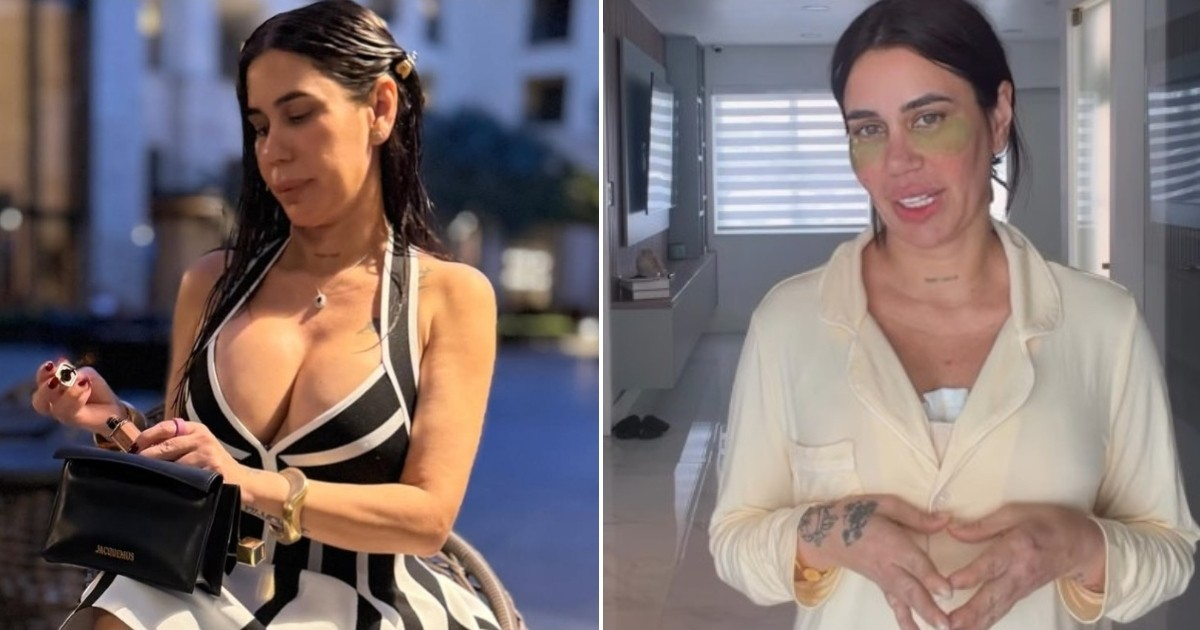 Yainelis "La Melliza" Ramírez Shares Post-Surgery Experience: "My Breasts Feel So Small"