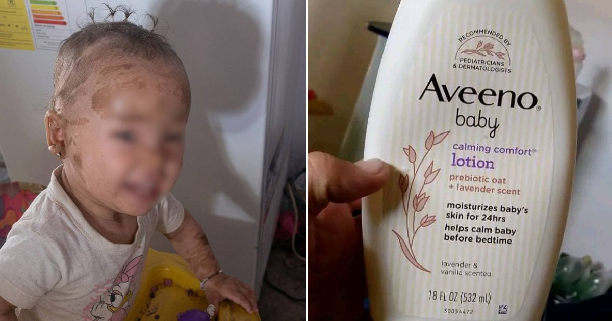 A Young Girl's Battle: Sancti Spíritus Child Desperately Needs Imported Cream for Rare Skin Disease