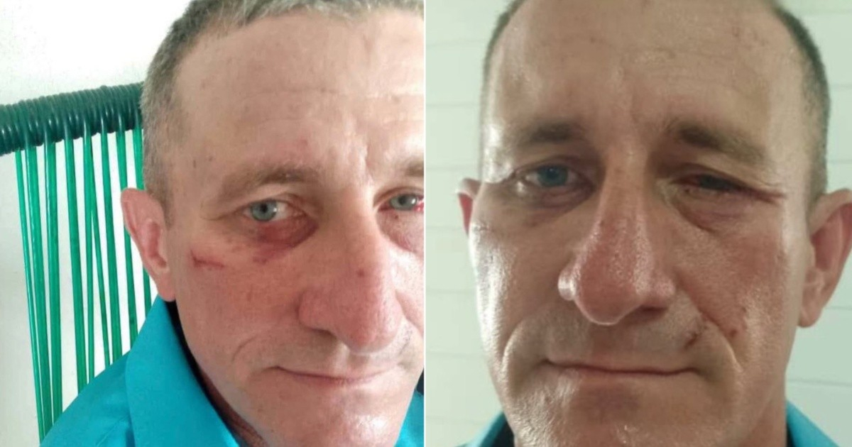 Intensive Care Doctor Attacked in Cárdenas Hospital Incident