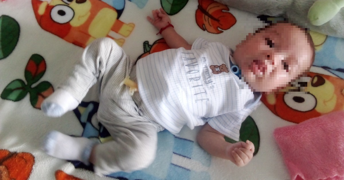 Cuban Mother Claims Hospital Negligence Traps Her Baby in Medical Limbo Since Birth