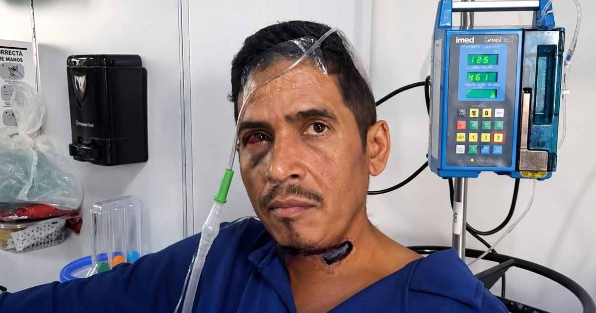 "Praying and Thinking of My Family": Hernán Gil's Harrowing Tale of Survival After 8 Days Trapped in Rubble in Venezuela