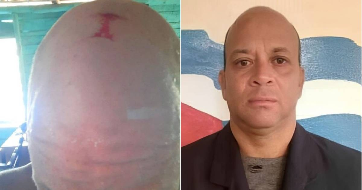Journalist Faces Brutal Assault and Death Threats for Reporting in Cuba