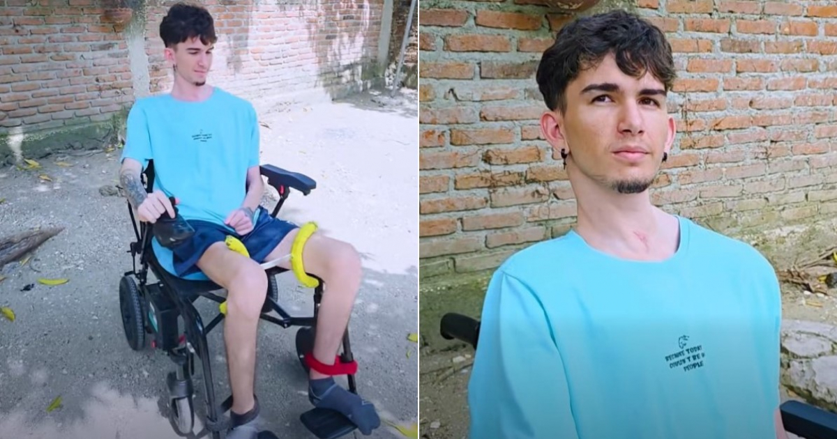 Lester Receives Electric Wheelchair Donation After Violent Attack in Holguín