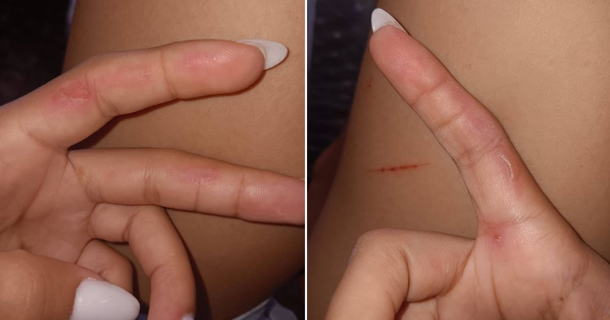 Cuban Woman Beats a Pot Until Her Hands Are Injured: "Freedom Belongs to the Brave"