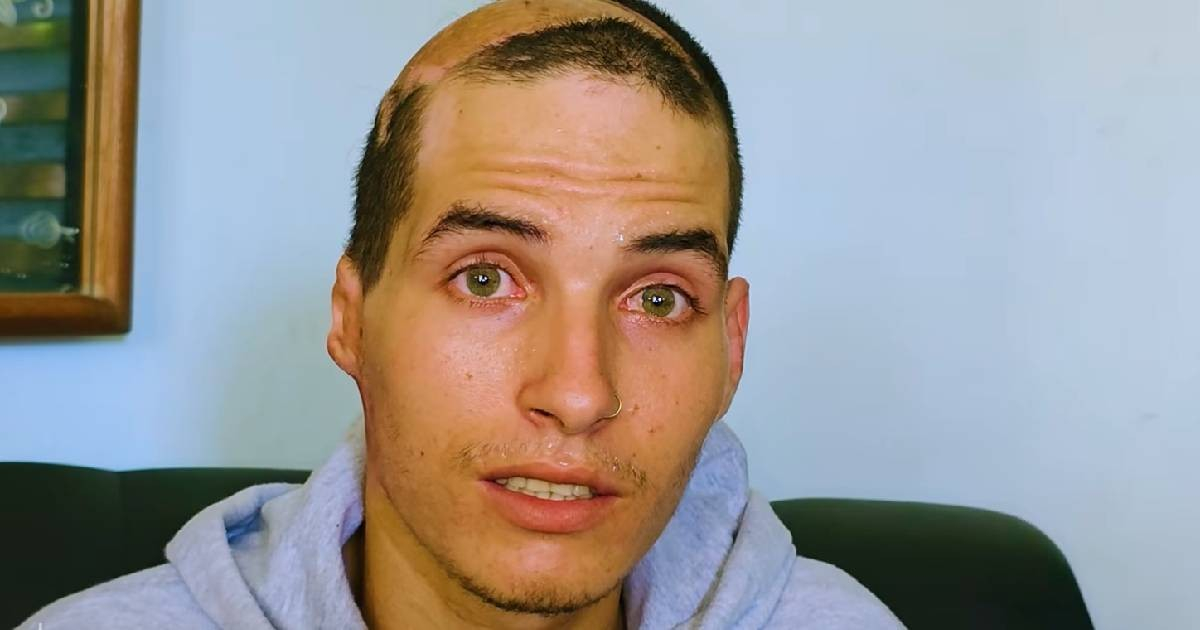From Tragedy to Triumph: Young Cuban Electrocution Survivor Finds a New Home