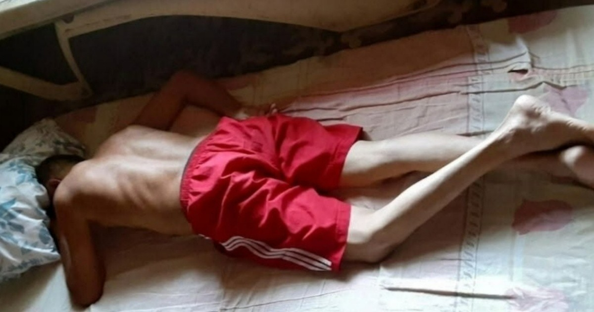 Guillermo del Sol Reaches Critical Point on Day 46 of Hunger Strike with Severe Dehydration