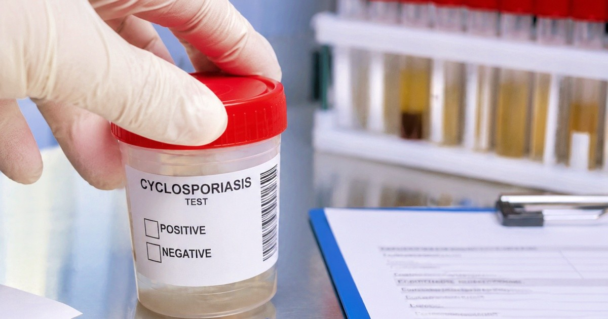 First Deaths from Cyclosporiasis Reported in the United States
