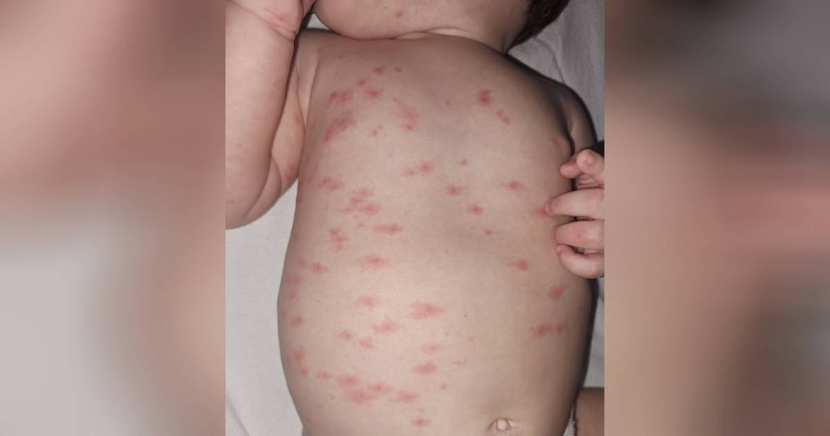 Cuban Mother Shares Heartbreaking Struggle to Raise Baby Amid Blackouts, Trash, and Mosquitoes