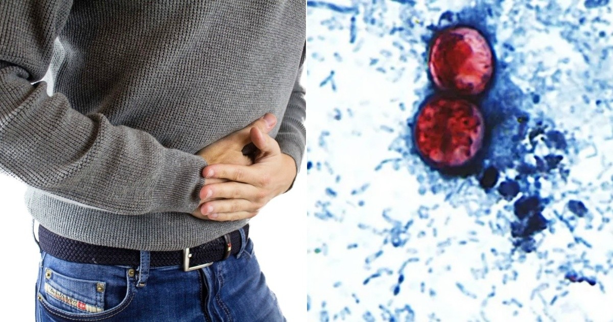 Cyclospora Outbreak Spreads to Six More U.S. States: Latest Developments