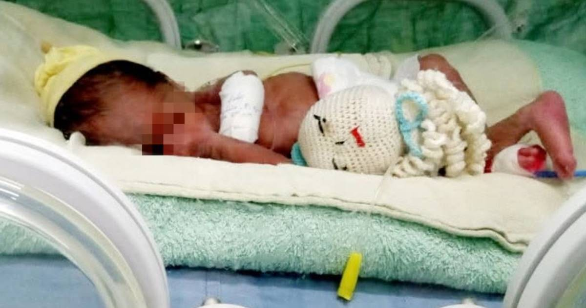 Tiny Miracle: Preemie in Santiago de Cuba Becomes First to Receive 'Comfort Octopus'