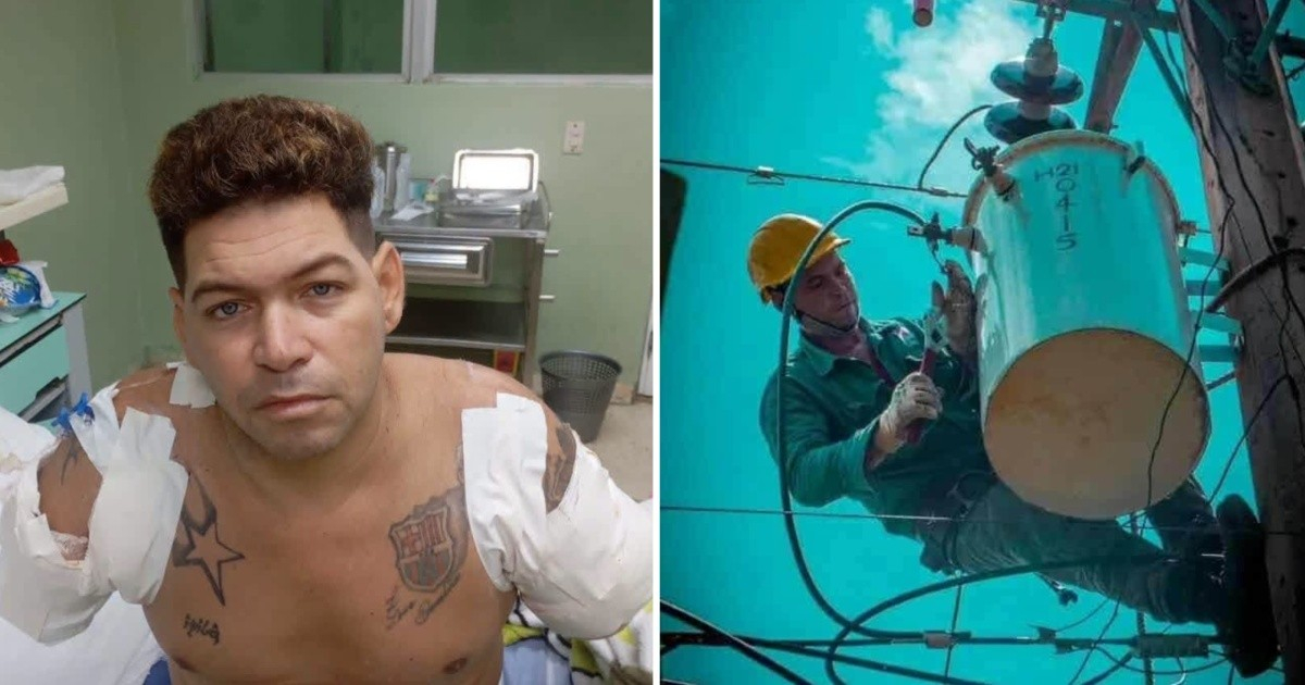 Former Cuban Lineman Seeks Assistance After Losing Both Arms in Work Accident