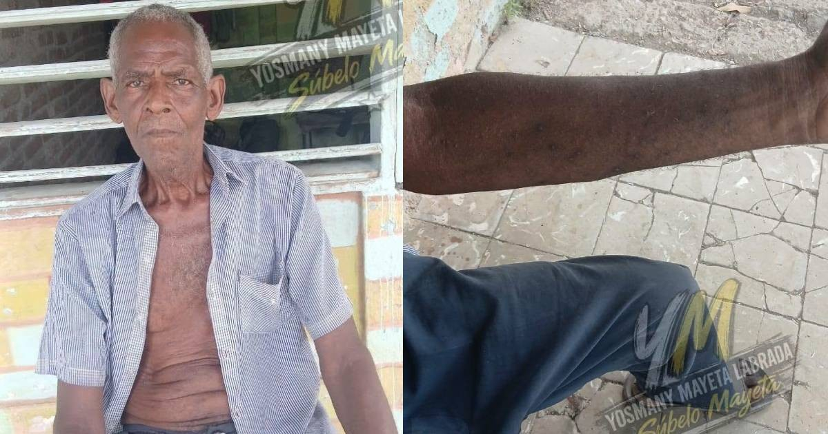 Father of Cuban Journalist Told to Seek Medicine on Black Market Amid Shortage