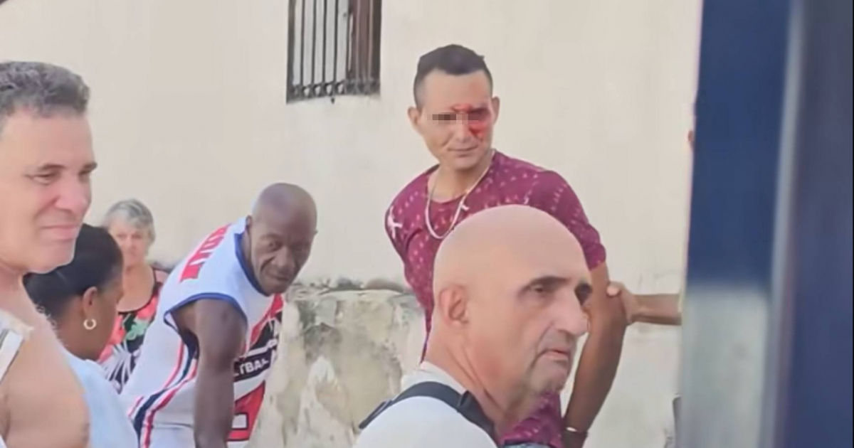 Alleged Thief Nabbed in Broad Daylight in La Caridad, Cuba