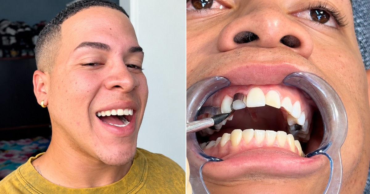 Cuban Comedian Dares to Get a Smile Makeover in Cuba: Here's What Happened