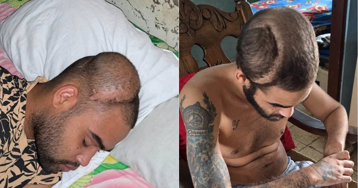 Urgent Call for Support for Young Cuban with Brain Tumor