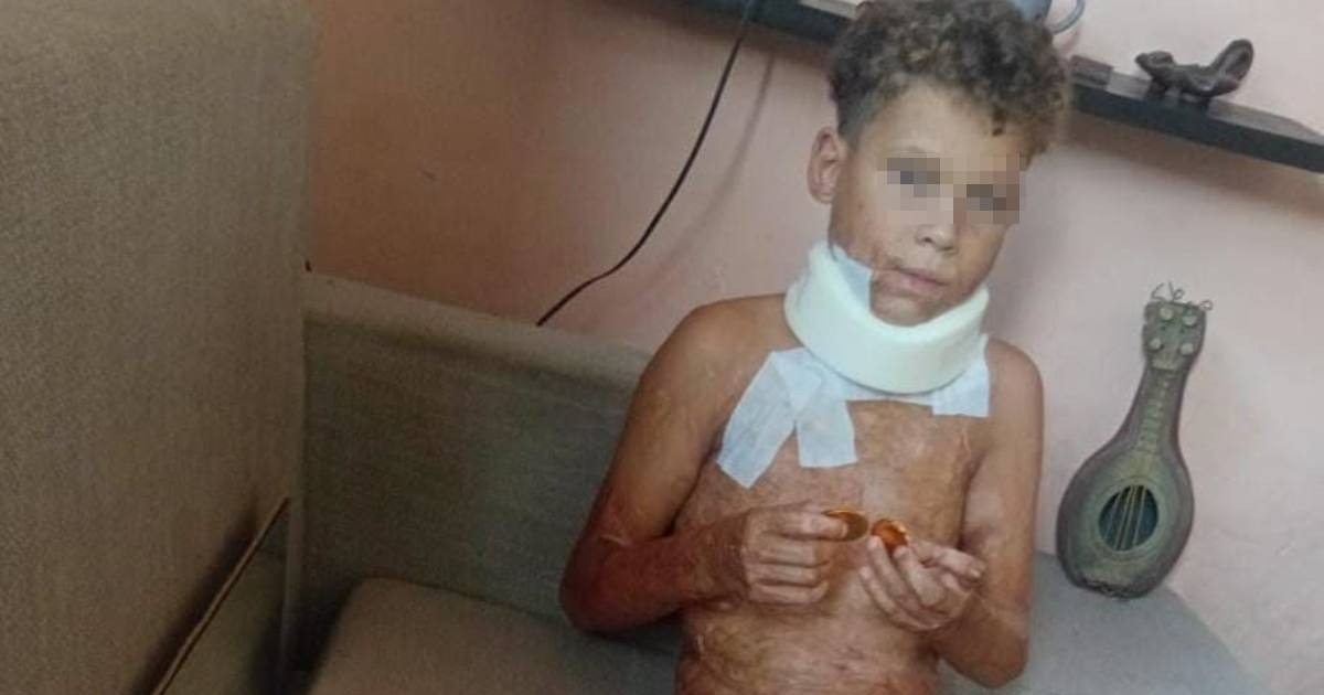 Cuban Boy on the Mend After Life-Saving Surgery Aided by International Support