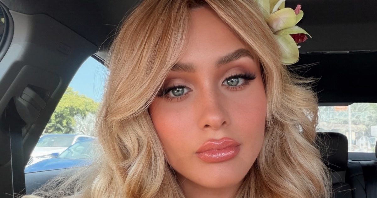 Mia Dio Opens Up About Facial Paralysis Caused by Botox