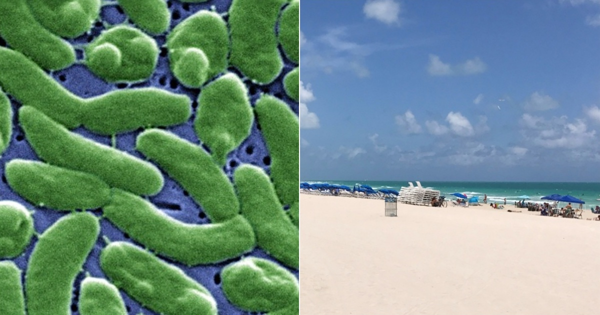 Deaths Surge in Florida and Louisiana Due to Flesh-Eating Bacteria