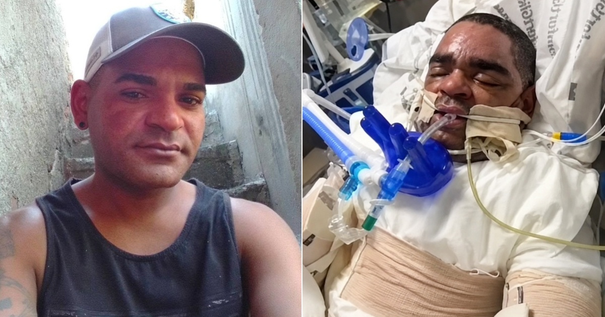U.S. Deports Cuban Man Unable to Appeal Case Due to Being in Coma: An In-Depth Look
