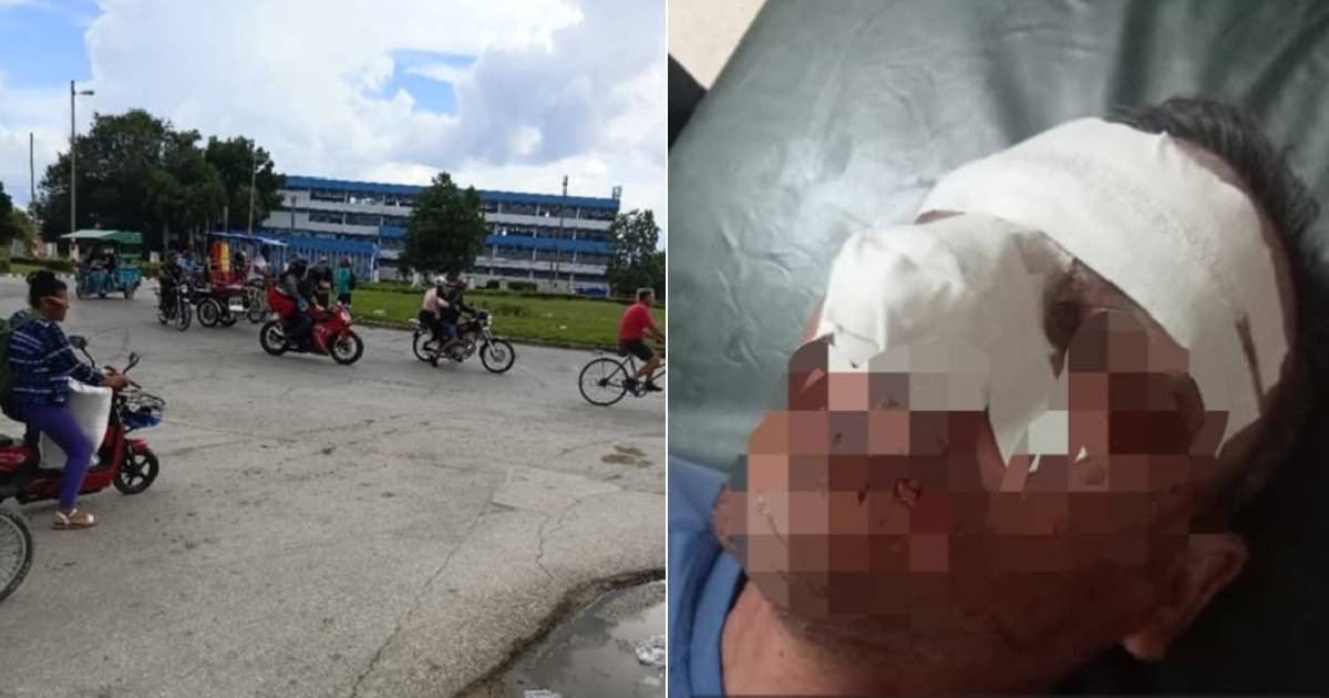Cyclist Under Medical Observation After Collision with Motorcycle in Camagüey Roundabout