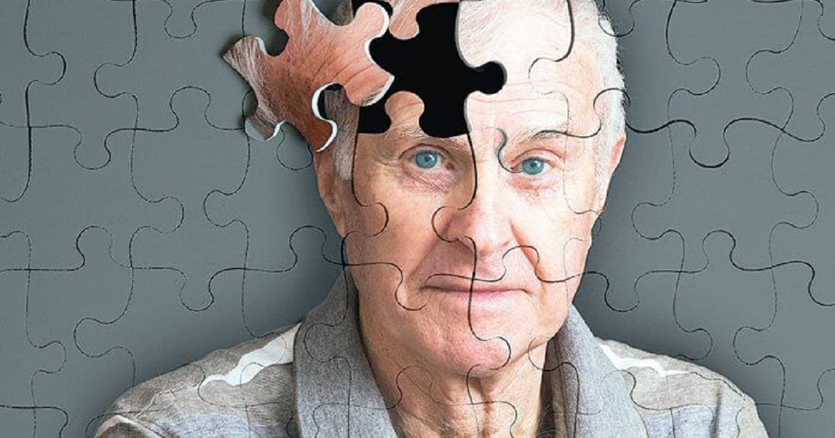 Enfermedad de Alzheimer © Pinterest