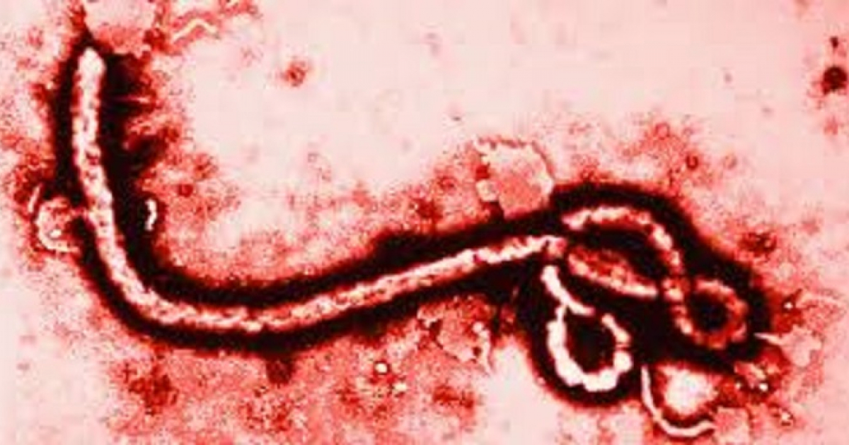 Virus del ébola © Scientaeblog.com