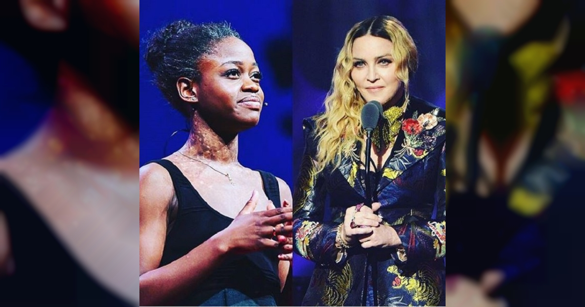 Madonna dirigirá pelicula sobre Michaela DePrince © Madonna / Instagram