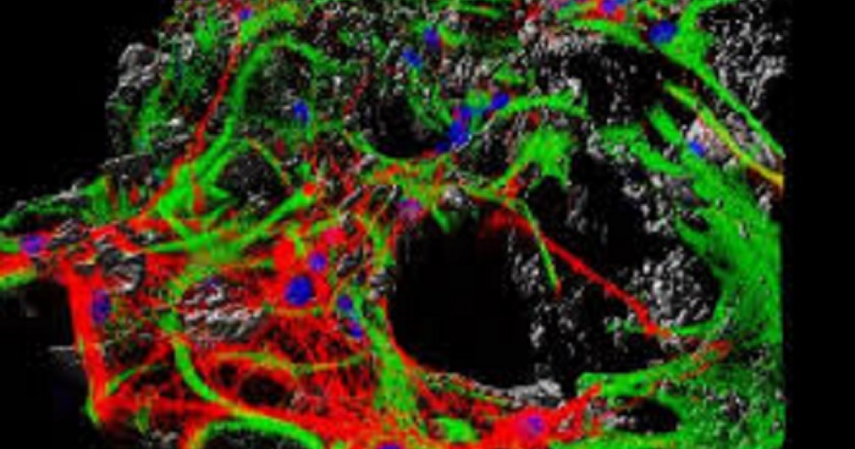 Nanotubos de carbono © La nanotecnología pudiera resolver las parálisis por lesiones de la médula espinal