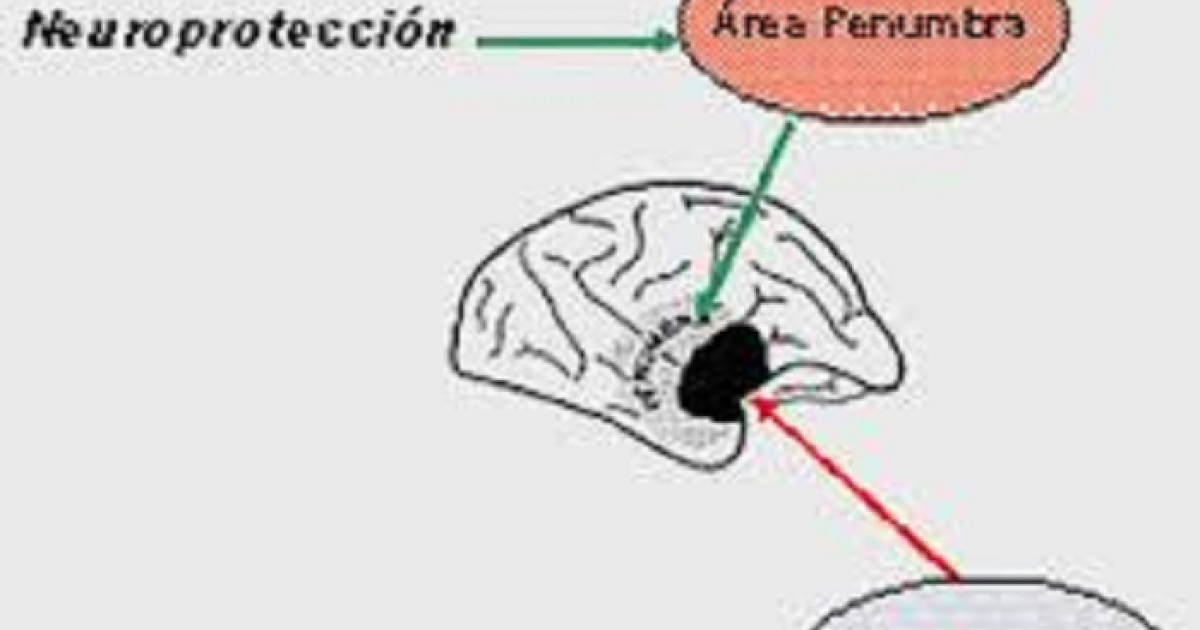 Sustancia neuroprotectora © Descubren cientificos cubanos molecula para tratamiento de isquemia cerebral