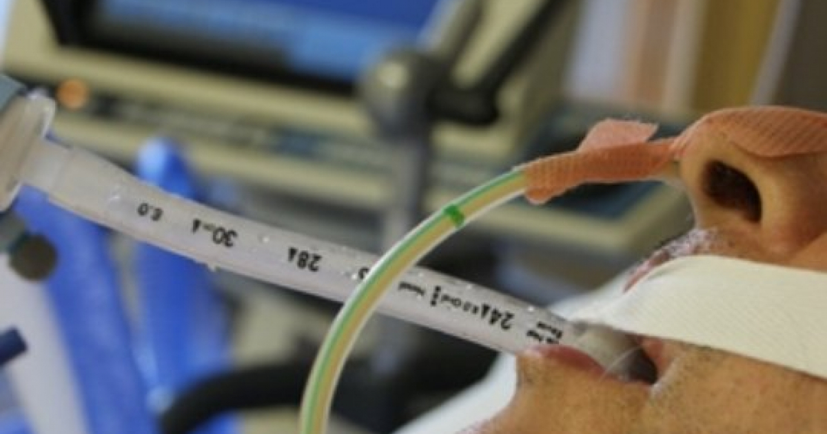 Paciente conectado a respirador artificial © jano.es